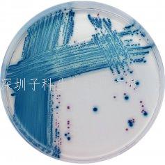 科玛嘉产志贺毒素大肠杆菌STEC造就基