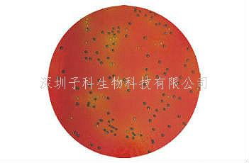 印度HiMedia 粪肠球菌显色造就基