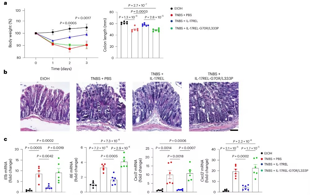 Nat Immunol：钱友存/杨涛发现节造肠路炎症的潜在新战术