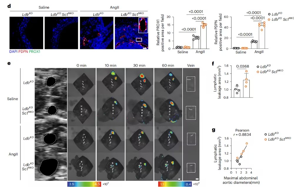 Nat Immunol：匹敌传统认知！复旦大学阮承超等团队揭示异常淋巴管天生驱动动脉瘤，，，，，，靶向Sparcl1/FGF2轴成新战术